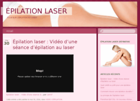 abc-epilation-laser.com