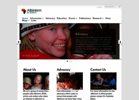 Albinism-in-africa.com