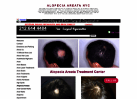 alopeciaareatanyc.org