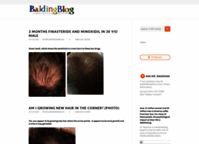 Baldingblog.com