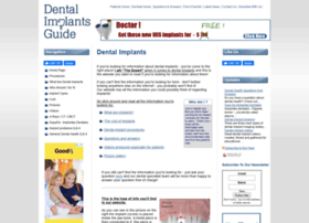 Dental-implants-guide.com
