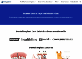 Dentalimplantcostguide.com