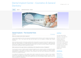 Dentalimplantschicago.weebly.com