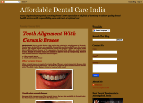 dentaltreatmentsindia.blogspot.in