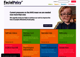 Facialpalsy.org.uk