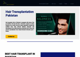 Hairtransplantationpakistan.com