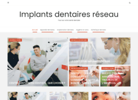 implants-dentaires-reseau.com