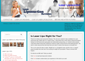 laserliposuctionreviews.com