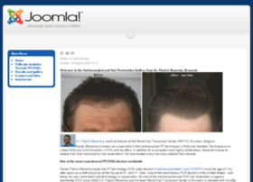 natural-hairtransplants.com