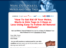 natural-mole-wart-removal.com