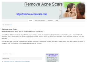 remove-acnescars.com