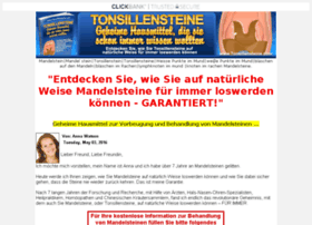 tonsillensteine.com