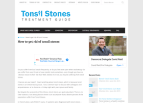 Tonsilstonesadvisor.com