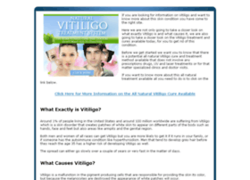 vitiligocure.blinkweb.com